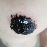 Black Salve Pasty, aka Initial Application